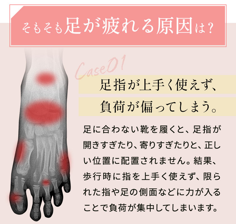 そもそも足が疲れる原因は？